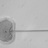 Insémination d'un ovule au microscope