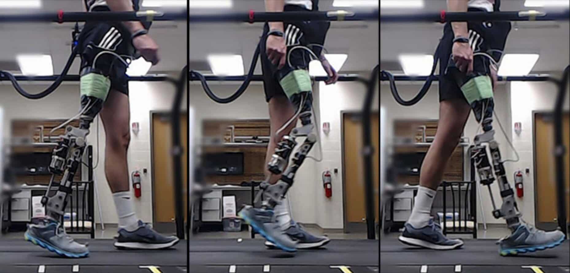 Une IA permet aux handicapés de marcher en quelques minutes avec leur prothèse.