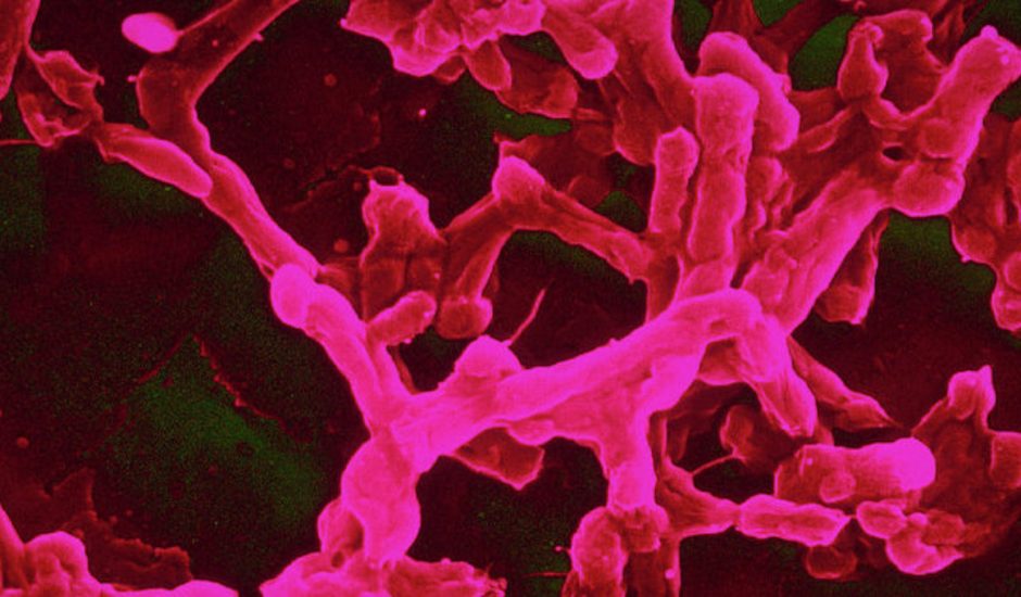 Une bactérie modifiée pourrait sauver nos cultures.