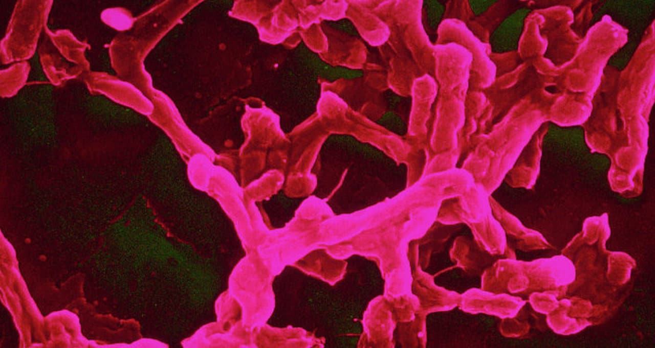 Une bactérie modifiée pourrait sauver nos cultures.