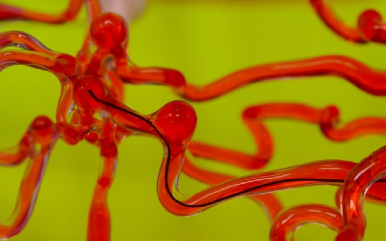 Un robot filiforme capable de soigner les vaisseaux sanguins du cerveau.