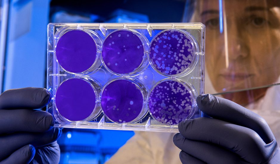 Intelligence artificielle : un chercheur tient des colonies de bactéries dans les mains