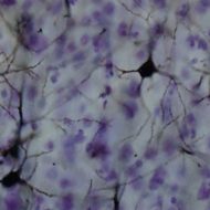 Des chercheurs explorent les neurones du cerveau humain.