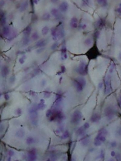 Des chercheurs explorent les neurones du cerveau humain.