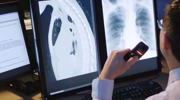 Médecin qui dicte dans un appareil devant des radiologies